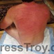 Freshly whipped back by Mistress Troy in her New York City dungeon
